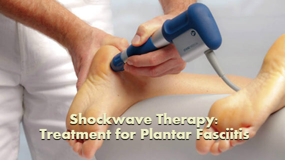 electric shock wave therapy for plantar fasciitis