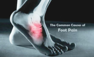 The Common Causes Of Foot Pain London Musculoskeletal Clinic